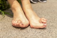 Early Rheumatoid Arthritis Symptoms in the Feet
