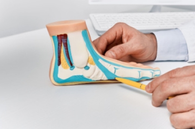 Pros and Cons of Flatfoot Surgery