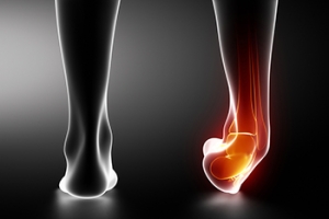 Treatment Options for a Torn Ankle Ligament